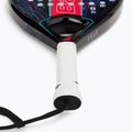 Babolat Contact Paddelschläger schwarz/blau 150115 4
