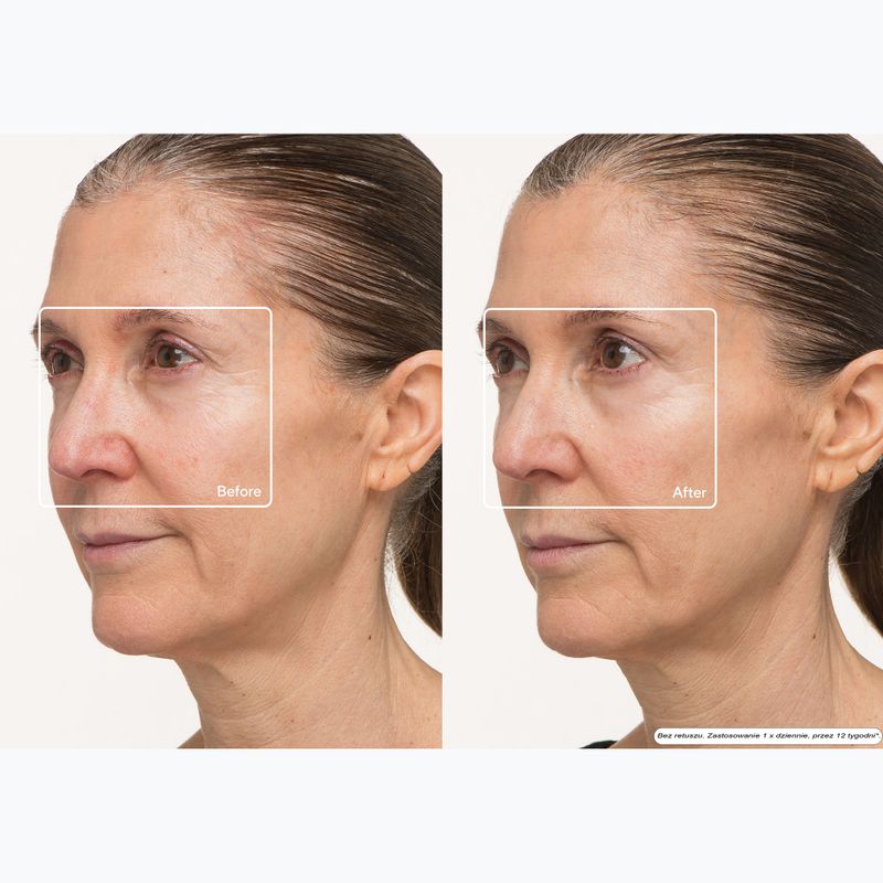 Gesichtsmaske LED Therabody TheraFace LED Mask 10