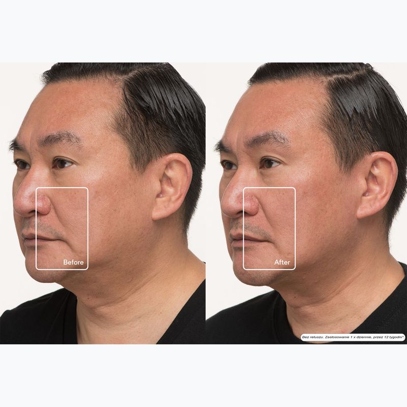 Gesichtsmaske LED Therabody TheraFace LED Mask 12