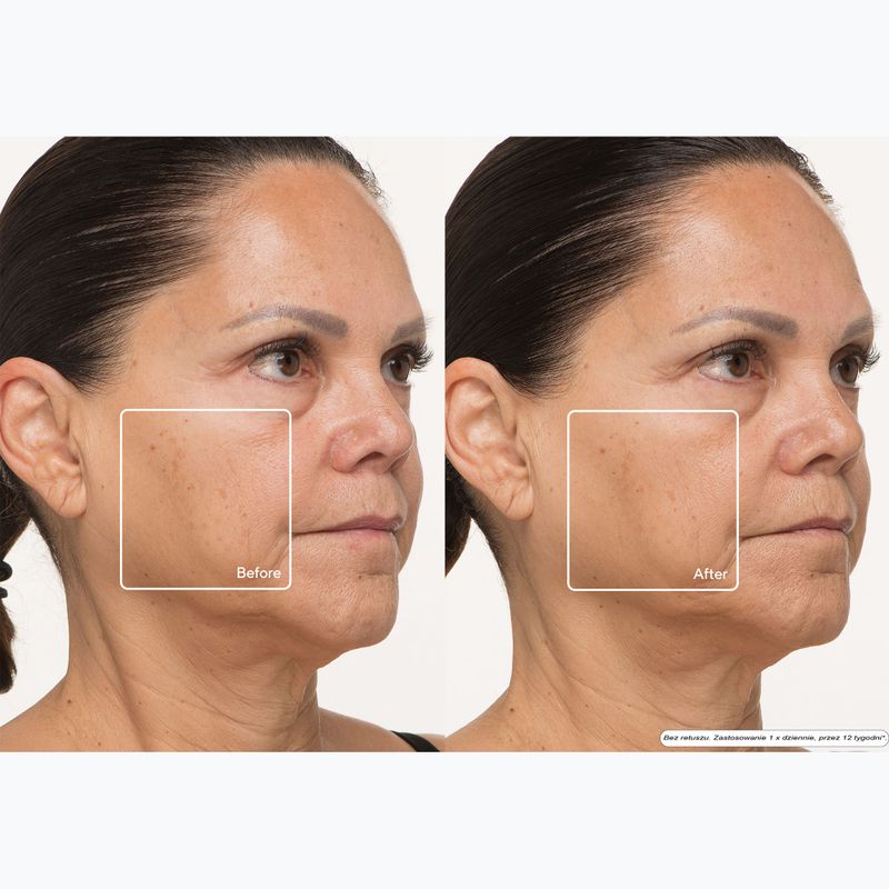 Gesichtsmaske LED Therabody TheraFace LED Mask 13